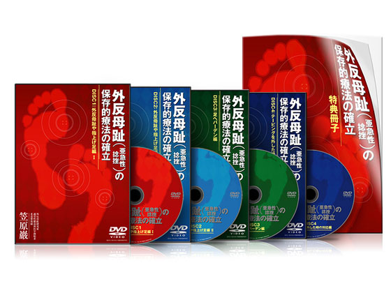 外反母趾（亜急性捻挫）の保存的療法の確立DVD│医療情報研究所DVD