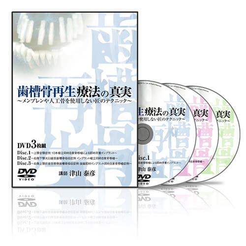 歯槽骨再生療法の真実2│医療情報研究所DVD