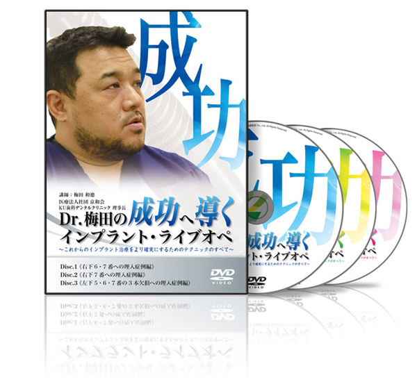 Dr.梅田の成功へ導くインプラント・ライブオペ│医療情報研究所DVD