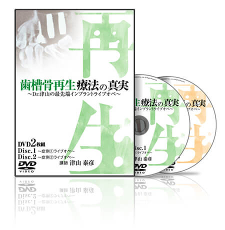 歯槽骨再生療法の真実〜Dr.津山の最先端インプラントライブオペ〜│医療情報研究所DVD